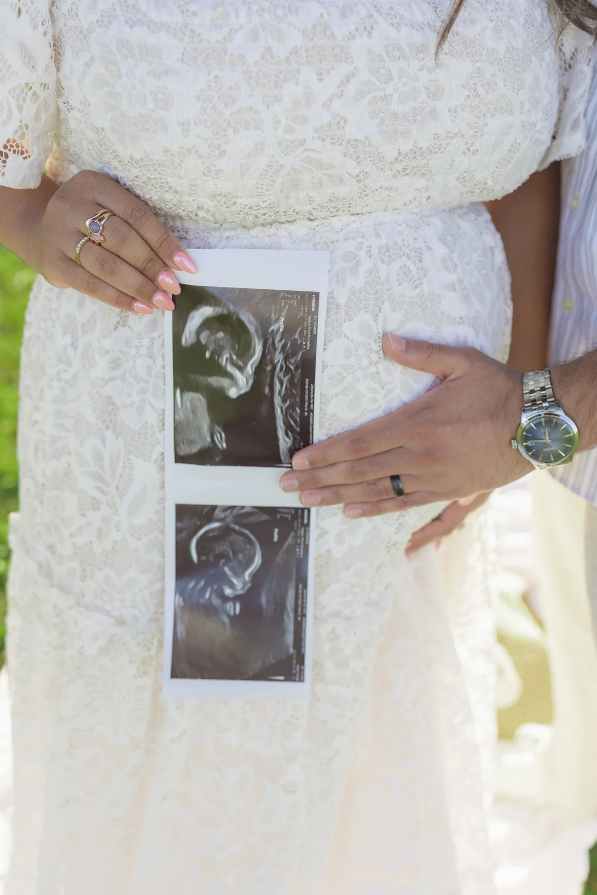 Ultrasound prints held against a white dress